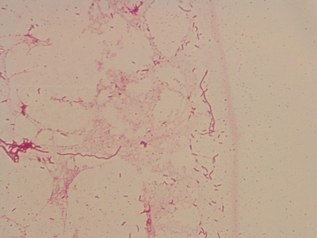 Bacillus Slides - Bacillus 08 1000X